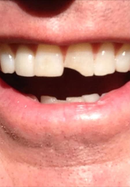 Jim Carrey Dumb and Dumber To Tooth
